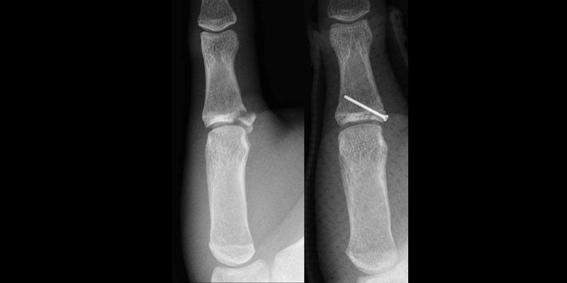 Handchirurg Wien, Handchirurgie, Arzt für Handverletzungen